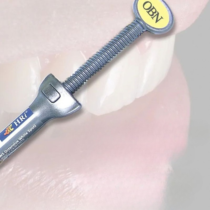 Dental Materials Meisu Aesthet - đánh giá và giá Uv Resin